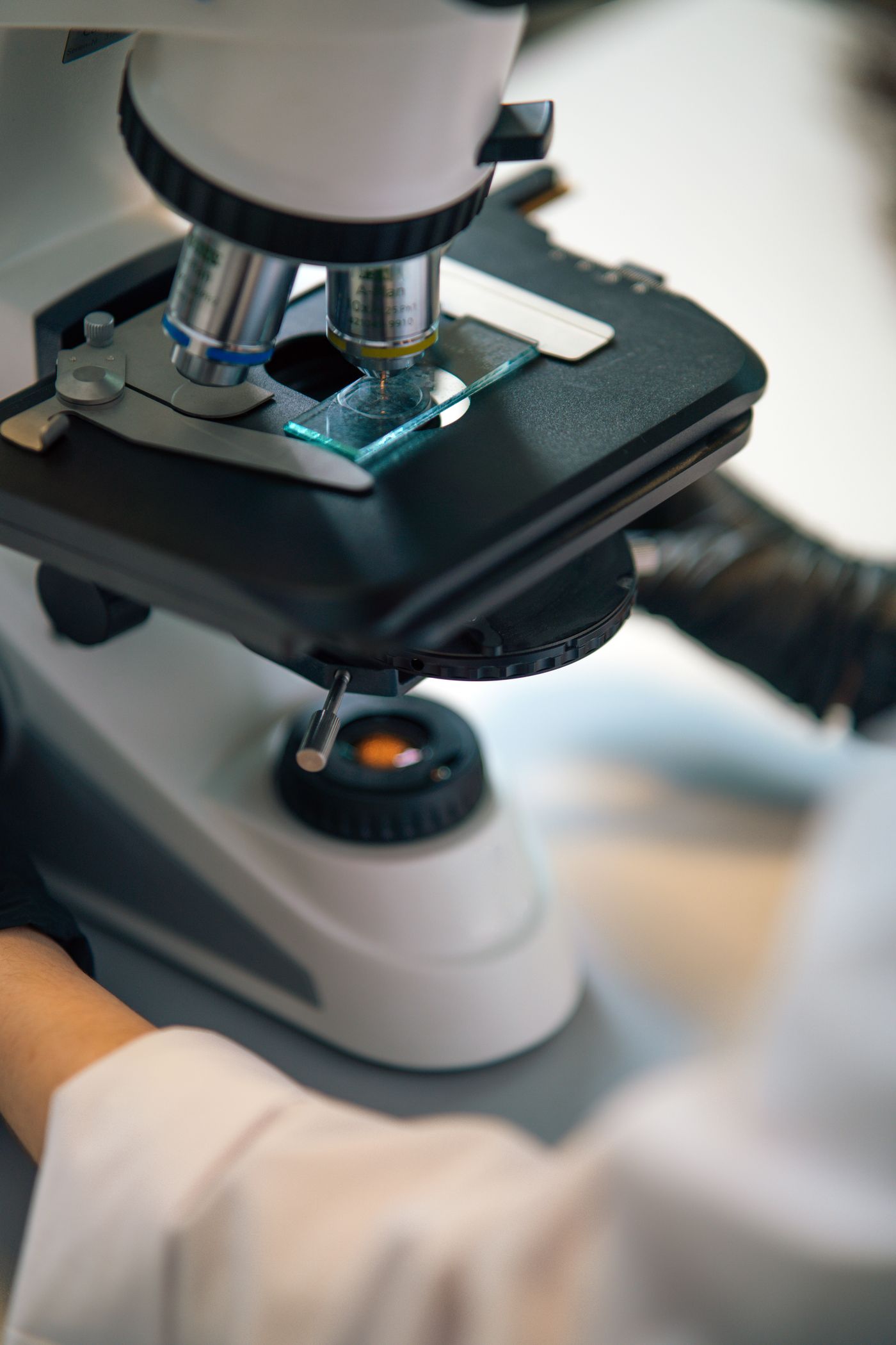 Anal Neoplasia & Cancer treatment in Los Angeles