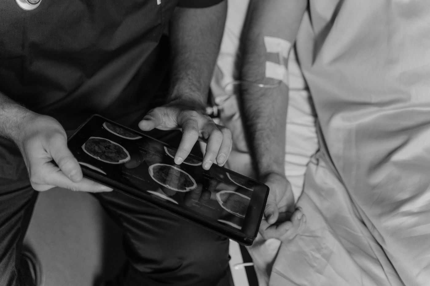 Rectal Cancer treatment in Los Angeles