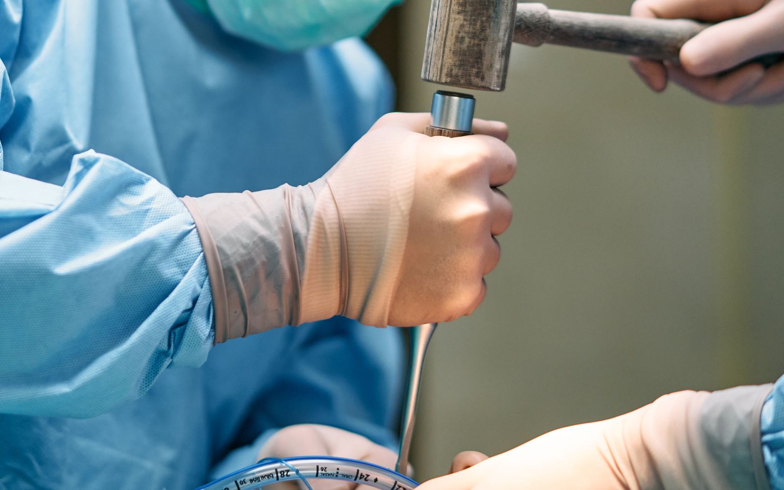 robotic colorectal surgery in Los Angeles