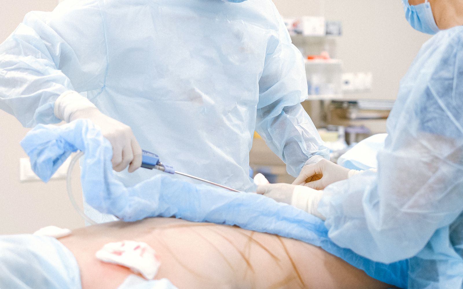 ulcerative colitis in Los Angeles